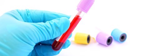 בדיקת MCHC - תמונה